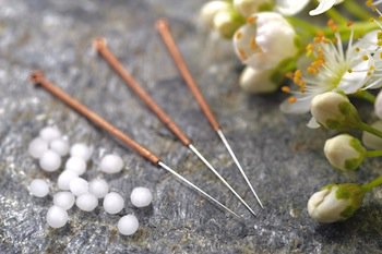 Acupuncture